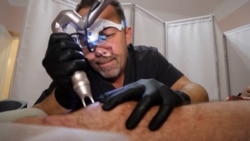 Vullnetarët ukrainas trajtojnë djegiet dhe vragat e luftës