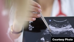 Иллюстративное фото 