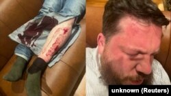 Leonyid Volkov orosz ellenzéki politikus sérülései a támadás után