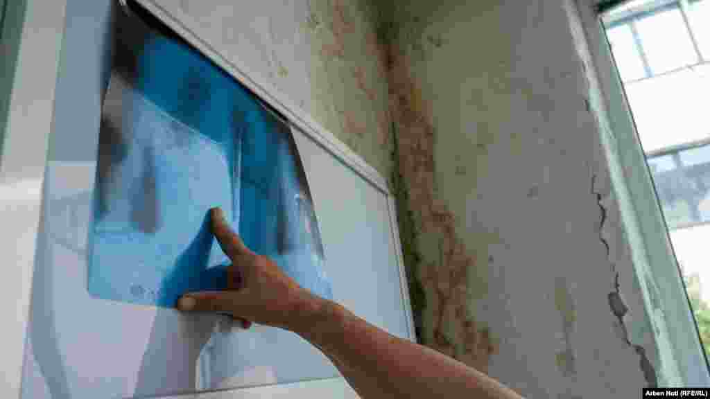 Mjeku në Qendrën Kryesore të Mjekësisë Familjare në Mitrovicë të Jugut shihet duke lexuar një rëntgen ndërsa muri ku është vendosur paneli shihet i dëmtuar nga lagështia.&nbsp;