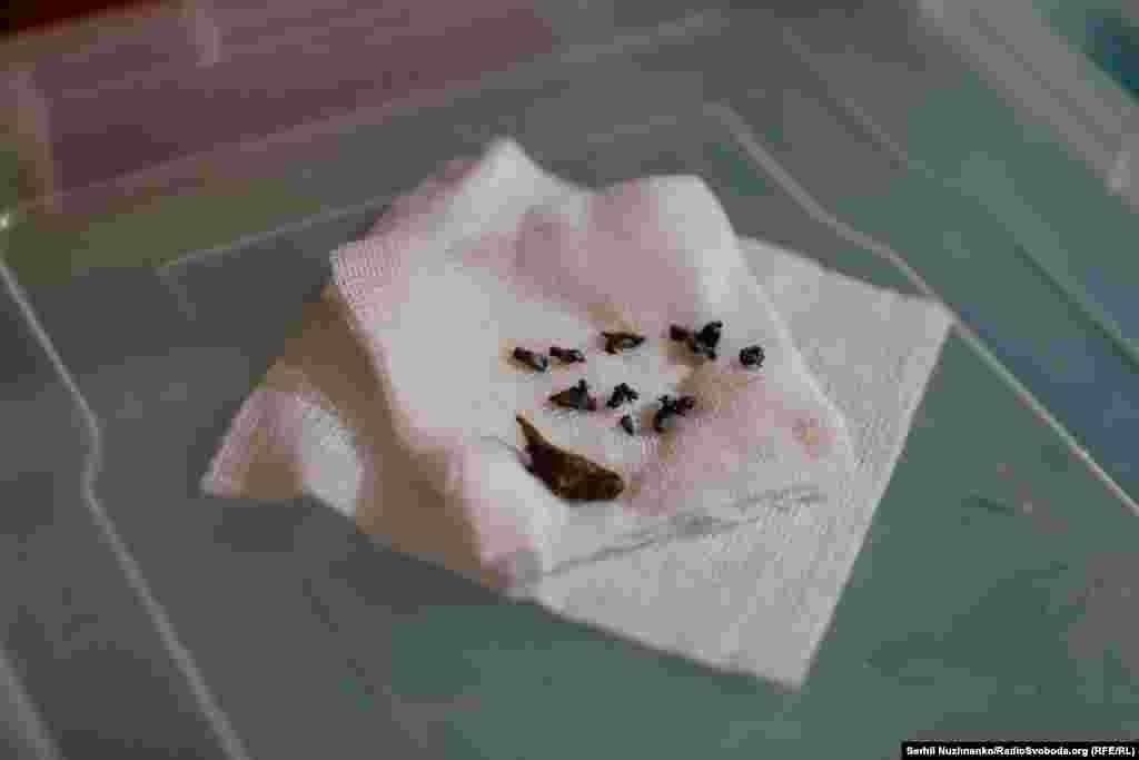 დაჭრილების სხეულებიდან ამოღებული ნამსხვრევების ფრაგმენტები. ავდიევკას მახლობლად მდებარე სამედიცინო დაწესებულება. 2024 წლის მარტი.