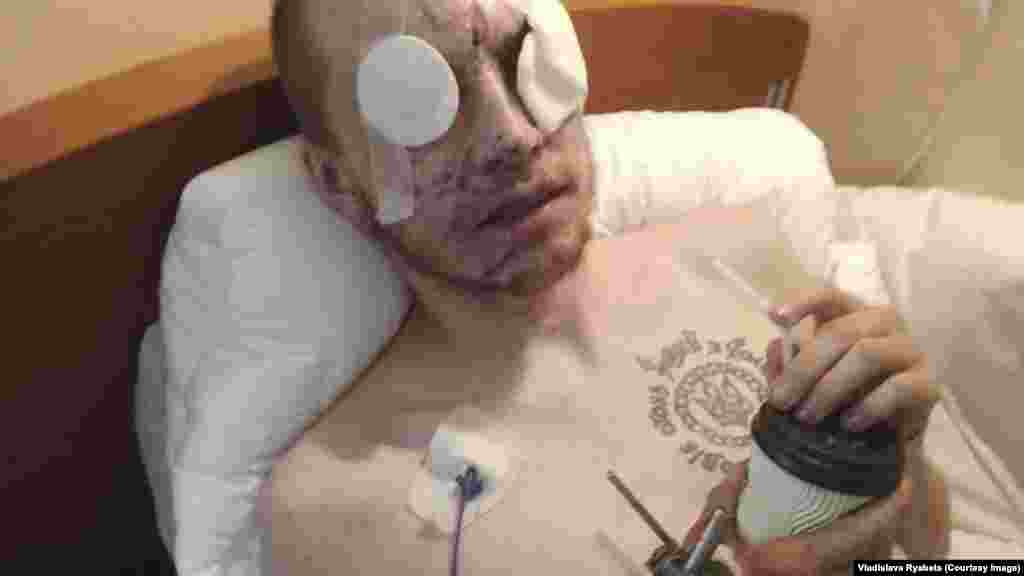 Më 2 gusht, afër fshatit Horlivka, njësia e Sorokës mori urdhër për t&#39;u tërhequr. Ata u tërhoqën kur ra terri, dhe deri në agim, ata u granatuan nga trupat ruse. Soroka u godit nga një copëz predhe e cila e verboi dhe gati sa nuk ndikoj që t&#39;i amputoheshin këmbët. &quot;Gjëja e parë që e thashë pasi u plagosa ishte &#39;kush do të më dojë mua tani?&#39;&quot;