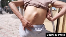 Последствия травмы Бека Шерикул уулу.