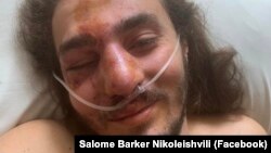 სამოქალაქო აქტივისტი ზუკა ბერძენიშვილი კლინიკაში თავდასხმის შემდეგ. 