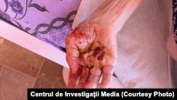 O frântură din coșmarul pe care îl trăiau bătrânii în căminele în care ar fi trebuit să fie îngrijiți, documentată de ancheta jurnalistică ce a dezvăluit de acum câteva luni ororile.
