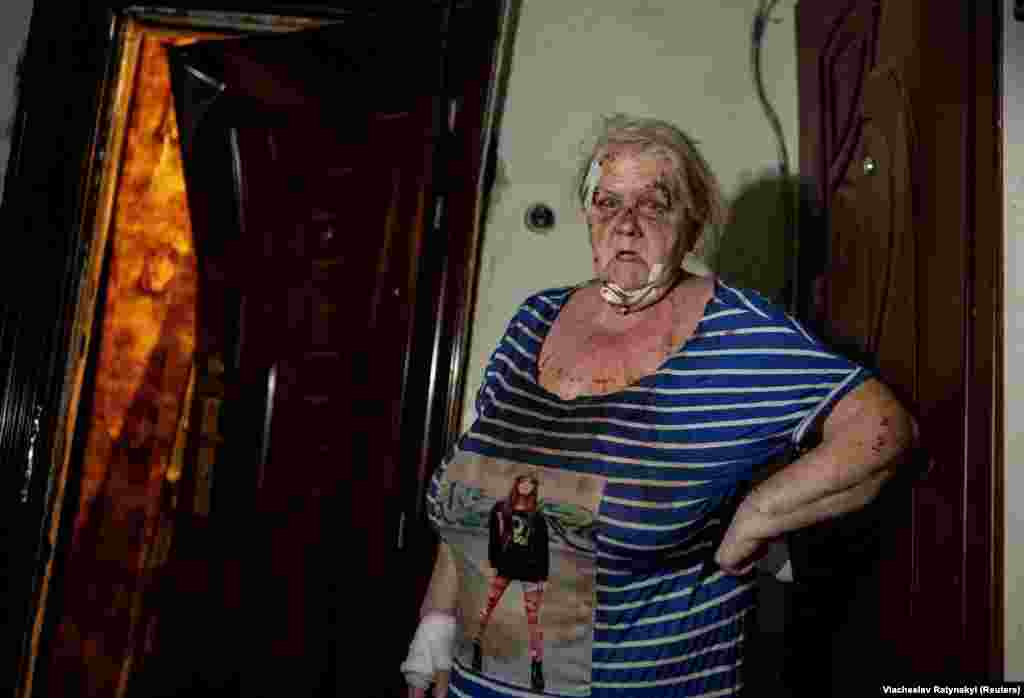 Atacul a rănit zeci de civili, inclusiv pe această femeie, precum și doi copii. &nbsp;