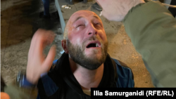 პარლამენტთან აქციაზე დაზარალებული ერთ-ერთი მოქალაქე. 2023 წლის 7 მარტი