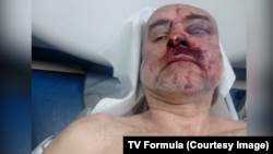 ცოლის ცნობით, "აგენტების კანონის" საწინააღმდეგო აქციაზე დაკავებულ და სასტიკად ნაცემ დავით ქაცარავას კლინიკაში მიყვანისას სასწრაფო ქირურგიული ჩარევა დასჭირდა. 