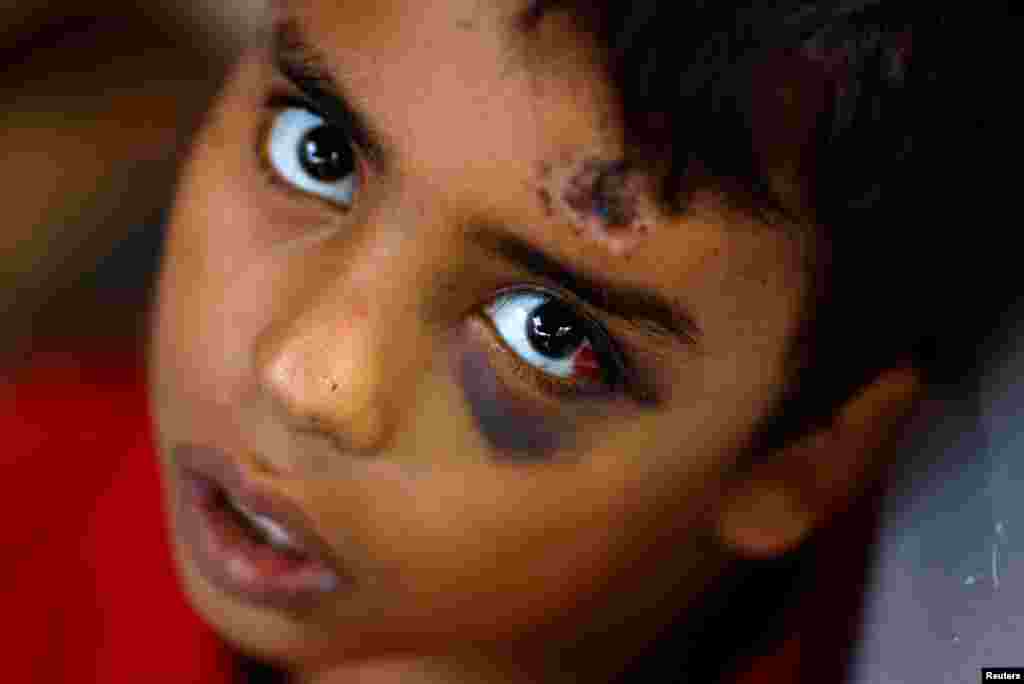 Një djalë i vogël palestinez, një nga të mbijetuarit e paktë të familjes Allamdani, i cili u largua në Rripin jugor të Gazës. Për t&#39;u ikur sulmeve të vazhdueshëm ajrore izraelite në qytetin e Gazës familja e tij u vendos në një strehimore, e cila u godit më vonë nga avionët izraelitë. Në këtë sulm u vranë 13 të afërm të tij.&nbsp;