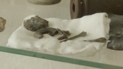 Spitali ukrainas ku trajtohen fëmijët e plagosur nga armë të ndaluara