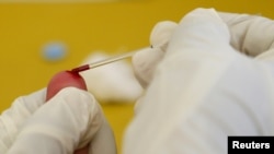 Testimi dhe terapia për HIV në QKUK, ashtu sikurse edhe në institucionet tjera publike të Kosovës, ofrohen falas.