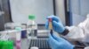 Virológiai vizsgálati minták a PTE Szentágothai János Kutatóközpontjának laboratóriumában 2023. február 7-én (képünk illusztráció)