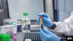 Virológiai vizsgálati minták a PTE Szentágothai János Kutatóközpontjának laboratóriumában 2023. február 7-én (képünk illusztráció)