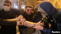 The events on May 1 turned violent, and in at least eight cases the victims claimed they were hit by rubber bullets. 