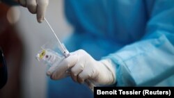 Një punëtor shëndetësor në Francë bën gati një test për koronavirus. Fotografi nga arkivi. 