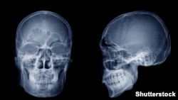 (Képünk illusztráció)