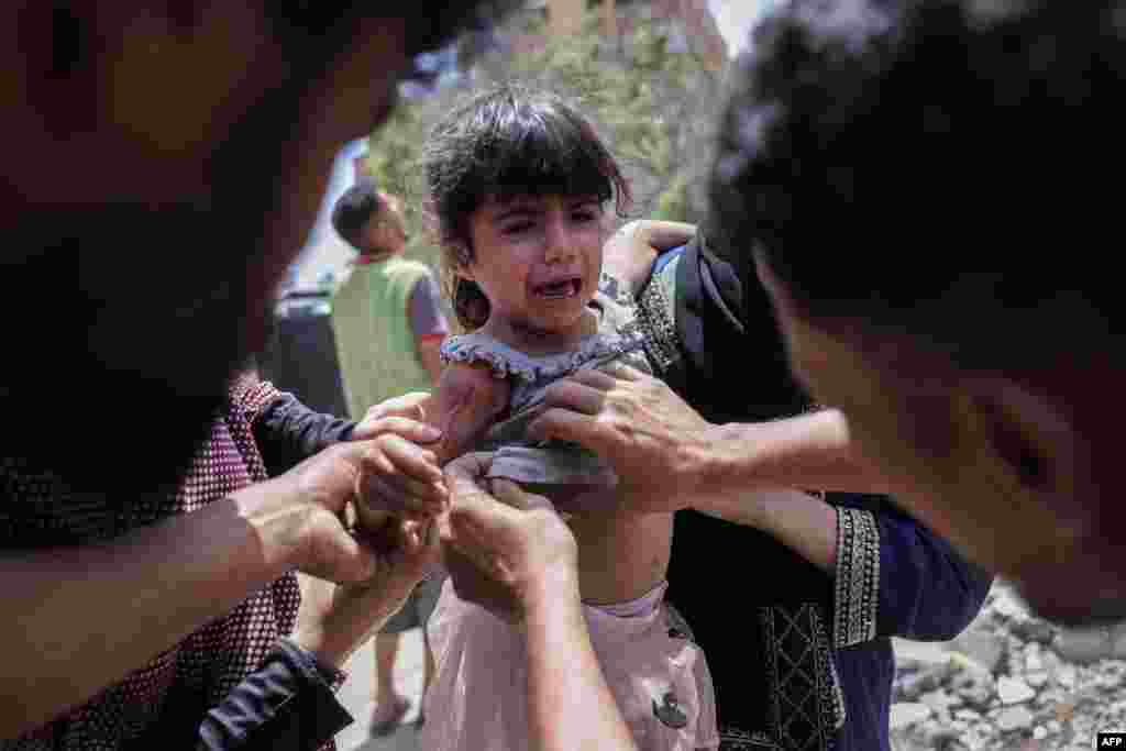 Palestinci brinu o djevojčici ranjenoj u izraelskom napadu u naselju Saftawi zapadno od Džabalije u sjevernom Pojasu Gaze 27. maja 2025.