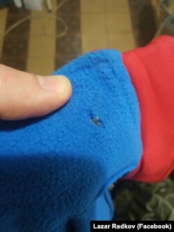 Осколка в дрехата на Радков