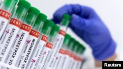 Svjetska zdravstvena organizacija očekuje da će se virus još širiti (ilustrativna fotografija, 23. maj)