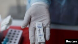 Позитивен ковид тест. Илустрација. 