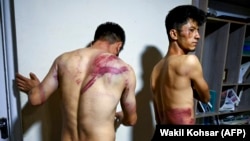 Афганистанските журналисти Немат Накди и Таки Дарябаши показват последствията от задържането им от талибаните. На журналистите в Афганистан беше обещана свобода