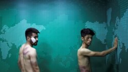 Dy gazetarë afganë rrihen brutalisht pas arrestimit nga talibanët