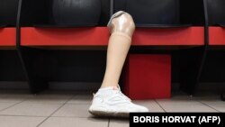 „Csináltak ugyan vizsgálatokat, de peregtek a hetek. Májusban jutottam el a biopsziáig, és június elején mondta meg az orvos, hogy nem tudja megmenteni a lábam” (Képünk illusztráció)