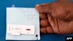 Testi i shpejtë për koronavirus.