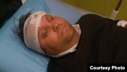 Илустрација - градоначалникот на Шуто Оризари, Елвис Бајрам повреден во тепачка меѓу две групи. Фото: Алсат-М