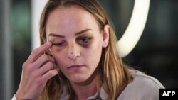 Марго Пино на пресконференция на 2 декември