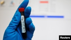 Epruveta sa uzorkom krvi, Ruski anti-doping laboratorij u Moskvi, ilustrativna fotografija