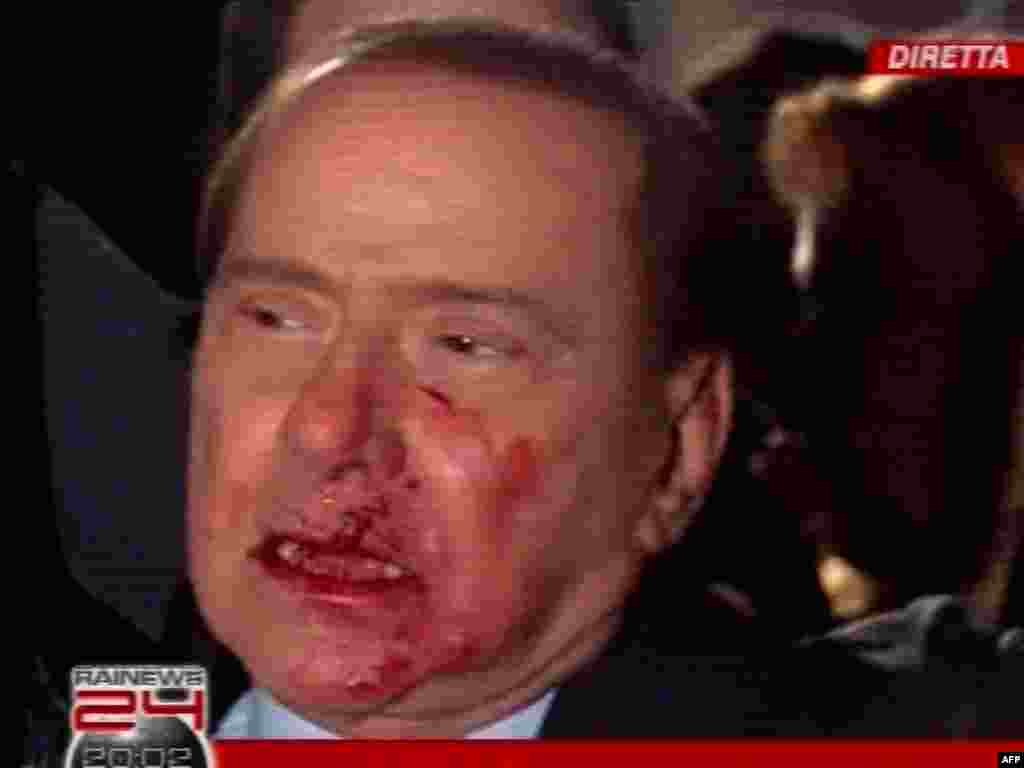 Принтскрин фотографијата го прикажува премиерот Силвио Берлускони откако беше нападнат во Милано, 13 декември 2009 година