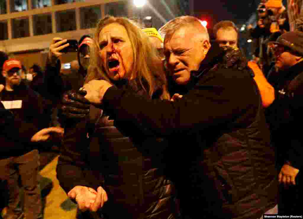 На повреден поддржувач на американскиот претседател Доналд Трамп му се помага по судирот со контра-демонстрантите за време на протестите во Вашингтон.