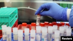 Laboratorija (fotoarhiva)