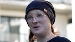 Bjeloruska komičarka s invaliditetom nastavlja rad u egzilu