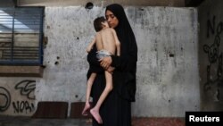 Një nënë palestineze mban në duar djalin e saj, i cili vuan nga kequshqyerja. Qyteti i Gazës, 24 korrik 2025. 