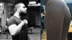 Леван Абесадзе и тело 15-летнего подростка, изрезанное ножом – фотоколлаж