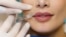 Close-up lips augmentation injections for attractive girl. Plastic surgeon does injection in lip in medical clinic.