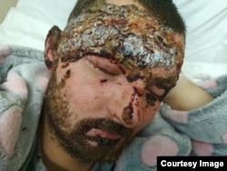 Вячеслав Астахов после ранения