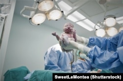 Ez a baba császármetszéssel született