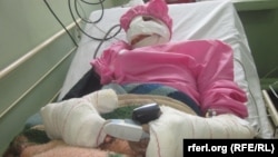 Afghanistan - Sitara, an afghan woman who lost her nose and lips. Sitara's husband cut her nose and lips with a knife and escaped, but police trying to arrest him. "said Afghan security authorities in western Afghanistan", 15 December 2013 