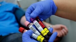 Примероци од крв донирани од оздравени пациенти со коронавирус