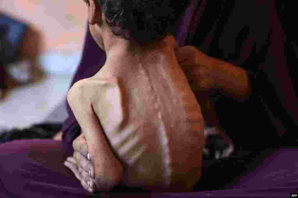 Naeema, 30-godišnja palestinska majka, sjedi sa svojim pothranjenim dvogodišnjim sinom Yazanom u njihovoj oštećenoj kući u izbjegličkom kampu Al-Shati, zapadno od grada Gaze, 23. jula 2025. godine.