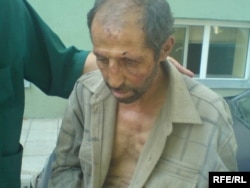 ცხინვალის ციხიდან გათავისუფლებული ნაცემი მოქალქე გორის ჰოსპიტლის ეზოში. 22 აგვისტო, 2008 წ.