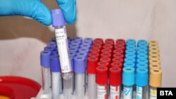 Разширява се капацитета на лабораториите да правят тестове за коронавирус