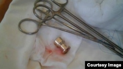 Снимок пули, извлеченной у одного из протестующих. Фото Кристофера Миллера, редактора Kyiv Post.