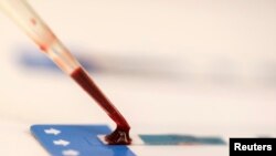 Броят на лабораторите, лицензирани за тестване за коронавирус в България ще се увеличи