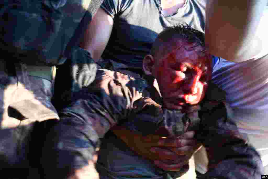 ეს თურქი ჯარისკაცი, რომელიც ბოსფორის ხიდზე მორიგეობდა, როგორც იტყობინებიან, ბრბომ მოკლა.