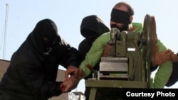 An Iranian convict has his fingers amputated as punishment.