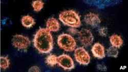 коронавирусот под електронски микроскоп